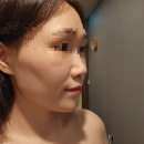 올리본 | 수원신부관리 올리다 에스테틱 웨딩케어센터 브이라인 탄력관리 후기