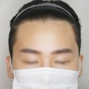 스타헤어라인 네이버블로그