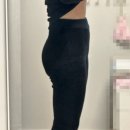 수원 다이어트병원 내돈내산 허벅지 지방분해주사 후기 (가격, 효과, 통증)