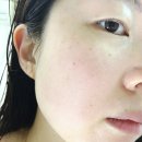 (주)더균형 | 팔자주름없애는운동 관리하다 팔주크림 사용하게 된 후기