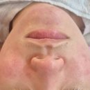 올가휴 | 예민 피부부터 아들 여드름까지 올가휴 혜원스킨테라피 후기