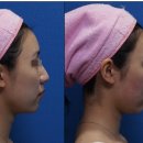 아름턱한의원 이미지