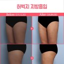 예슬림의원 이미지