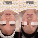 경기도 수원시 영통구 센트럴타운로 | [수원] 수원 영통 개인 맞춤 피부관리실 &#39;수원광교 피부관리 리은&#39; 솔직 후기