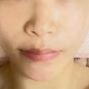 닥터힐럭스뷰티뱅크