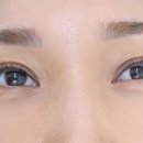 뷰티메디 이미지