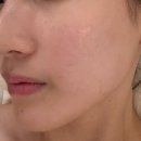 마디케어 | 수유역 피부관리 마디다에스테틱 웨딩케어 후기