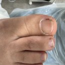 레푸스앤두두뷰티 | 불편했던 발 스케일링 케어 받고 온 의정부문제성발톱관리 레푸스 앤 두두뷰티