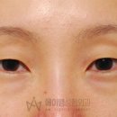 강남퍼스트성형외과의원 이미지