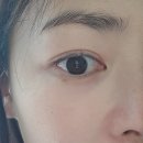 미드림의원 | 수원 미드림 성형외과 피부과 점빼기 후기, 전화 예약 방법
