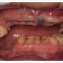 부평그랜드약국 | 부평역임플란트? 2가지 없으면, 절대 잘하는곳 아닙니다.