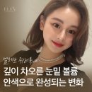 청담솔루션의원 | 청담피부과 눈밑 스킨부스터 잘하는곳 추천! 쥬베룩아이 시술 효과, 탄력관리와 통증, 가격