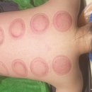 창신빌딩 | 남구바디관리 선택한 카라에스테틱 등관리 받고 느낀 리얼 후기+신부관리 추천