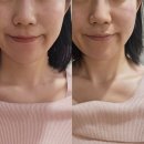 나날이좋은날 | 자양동 에스테틱 나날에스테틱 재방문 솔직후기