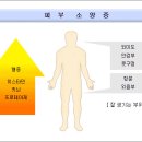 피부 소양증 이미지