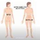 베라바디테라피 이미지