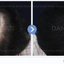다나두피 이미지
