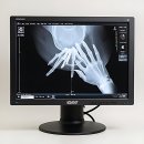 오케이연합의원 | 내 치아 인생 현타 쎄게 맞은 썰 푼다