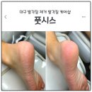 편안함과 건강한 셀프 발관리 | 대구 발각질제거 샵 추천｜풋시스 발각질케어 후기