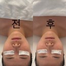 코아메디칼 | 부산 리프팅 잘하는 곳 윤곽관리 받으러 코아페이즈 솔직후기