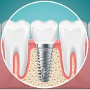 서구치과의원 이미지