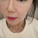 이룸디자인스킨왕십리역사점 | 왕십리피부과 올리디아 365 콜라겐부스터 주사 눈밑 팔자 자연스럽게 볼륨채우기 (내돈내산 리얼후기)