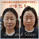 힐링휴앤샵