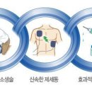 심폐소생술(CardioPulmonary Resuscitation : CPR ) -이란? 이미지