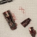 영치과기공소 | 가평치과, 의사들은 임플란트 브랜드 안 봅니다 [의사 작성]