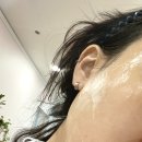 [동대문 피부관리]인셀덤 위더스 무료체험 후기