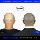 임플레오