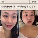 (주)하이푸헬스케어 | 하이푸 고주파 리프팅 주기, 리디아뷰티 왕십리 피부관리샵 후기