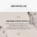 정 헤어라인 이미지