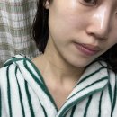 압구정페이스라인성형외과의원 | 압구정역 피부과 튠페이스 효과 리프팅 가격 내돈내산 후기