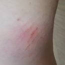 대정연합의원 네이버블로그