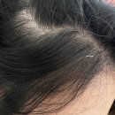 오산 세교,수청 클리닉 전문 미용실 &#39;사계절 미용실&#39; 두피케어 후기