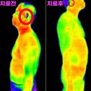 청원프라자 | 부천이명 치료, 잘하는 곳 찾아도 재발했던 분만 보세요