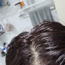 지성슈퍼 - 중구 보문산공원로497번길 6 | 헤킨솔 슈퍼헤어 탈모샴푸｜하루만 안 감아도 떡지는 초지성두피 사용후기