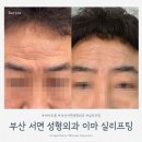 바로서면병원 (급식소포함) | 부산 서면 성형외과 부모님 효도관리 이마주름 고민끝 이마 실리프팅 후기
