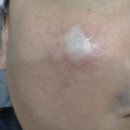 칙칙했던 피부톤 안녕! 물광 토닝 + 흑자 집중 케어로 광채 폭발!! 용전동 'OVEL태닝&amp;뷰티' 동안 케어 후기