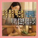 데린 | 피멍 빨리 빼는법, 생기는 이유 알려드림
