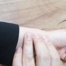 바로스탑한의원 이미지