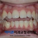 아이콘치과교정과의원 네이버블로그