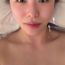 선화PC | 광주 웨딩관리 오월에스테틱, JH윤곽술 예신추천