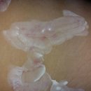 성광통상 | 대상포진이 안 아프게 온 건에 대해서