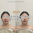 대구 동성로 작은얼굴관리 잘하는 제이스킨 솔직후기