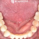 수지좋은치과의원 이미지