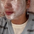 240 | 부천 피부과 콜라겐주사 스킨부스터 올리디아240 후기 (팔자주름 눈밑꺼짐 효과)