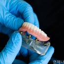 이든치과의원 네이버블로그