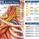 상완신경총(Brachial Plexus)과 신경 포착 목·어깨·팔 저림의 원인과 근막이완 접근 이미지